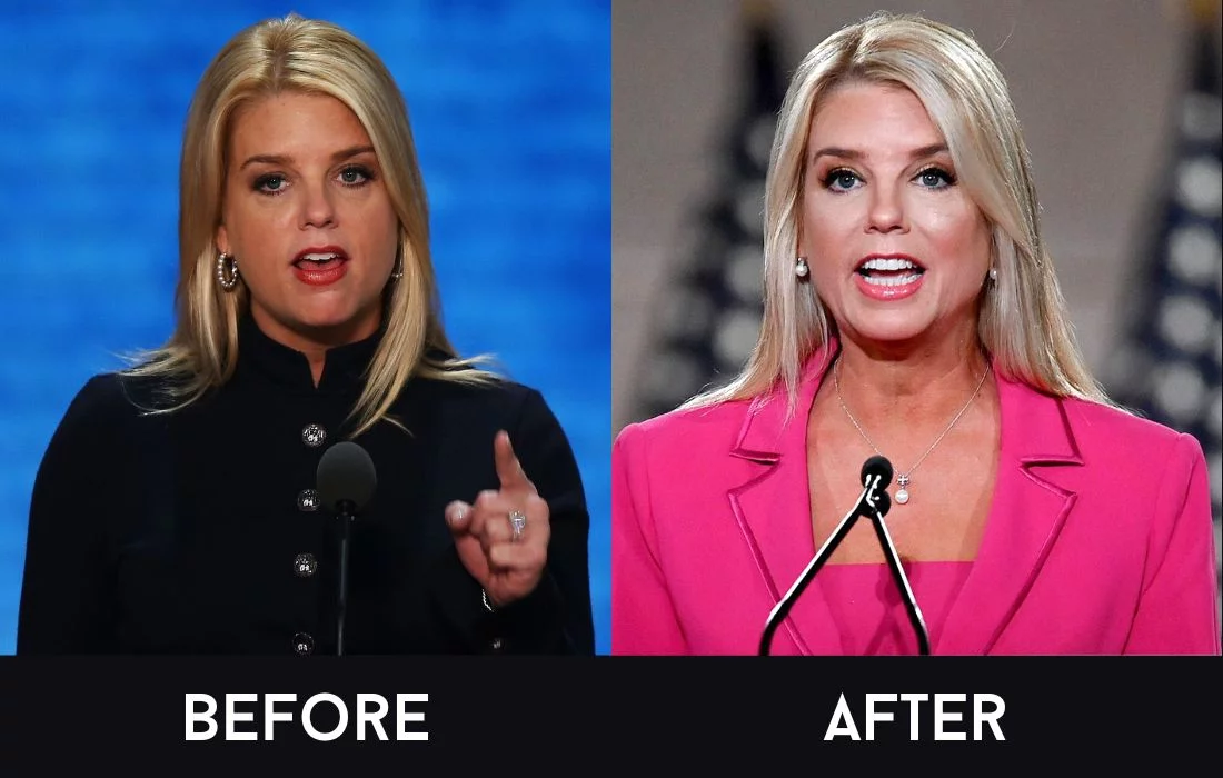 Pam-Bondi-Before-and-After