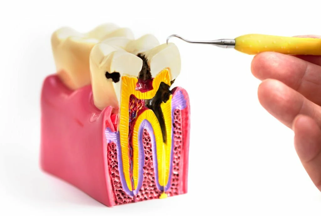 what is periodontics